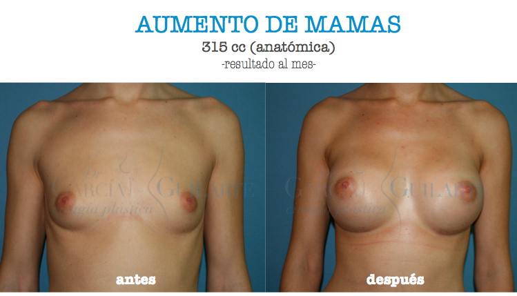 Los trajes de baño a las muchachas con un pequeño pecho